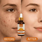 Relax Vitamin C Daily Serum - 30ml | Visibly Brightens, Evens Skin Tone, and Reduces Aging Signs for a Radiant, Youthful Glow